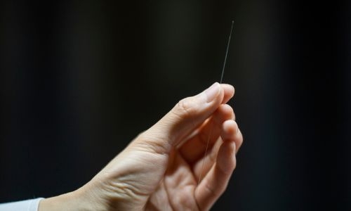 image of the hair-thin imaging device